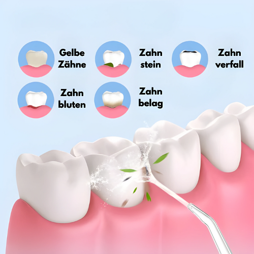 CleanSmile™ - Wasserflosser für die Mundhygiene [Letzter Tag Rabatt]